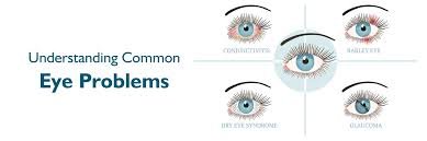 Understanding Vision Problems: Insights from Ophthalmologists Ophthalmologists